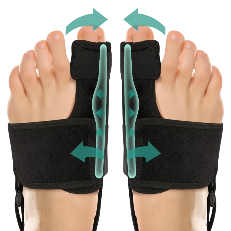 Valgux Brace | Teencorrector bij scheefstand (Hallux Valgus)